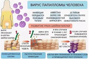 Организовано ВПЧ – тестирование.